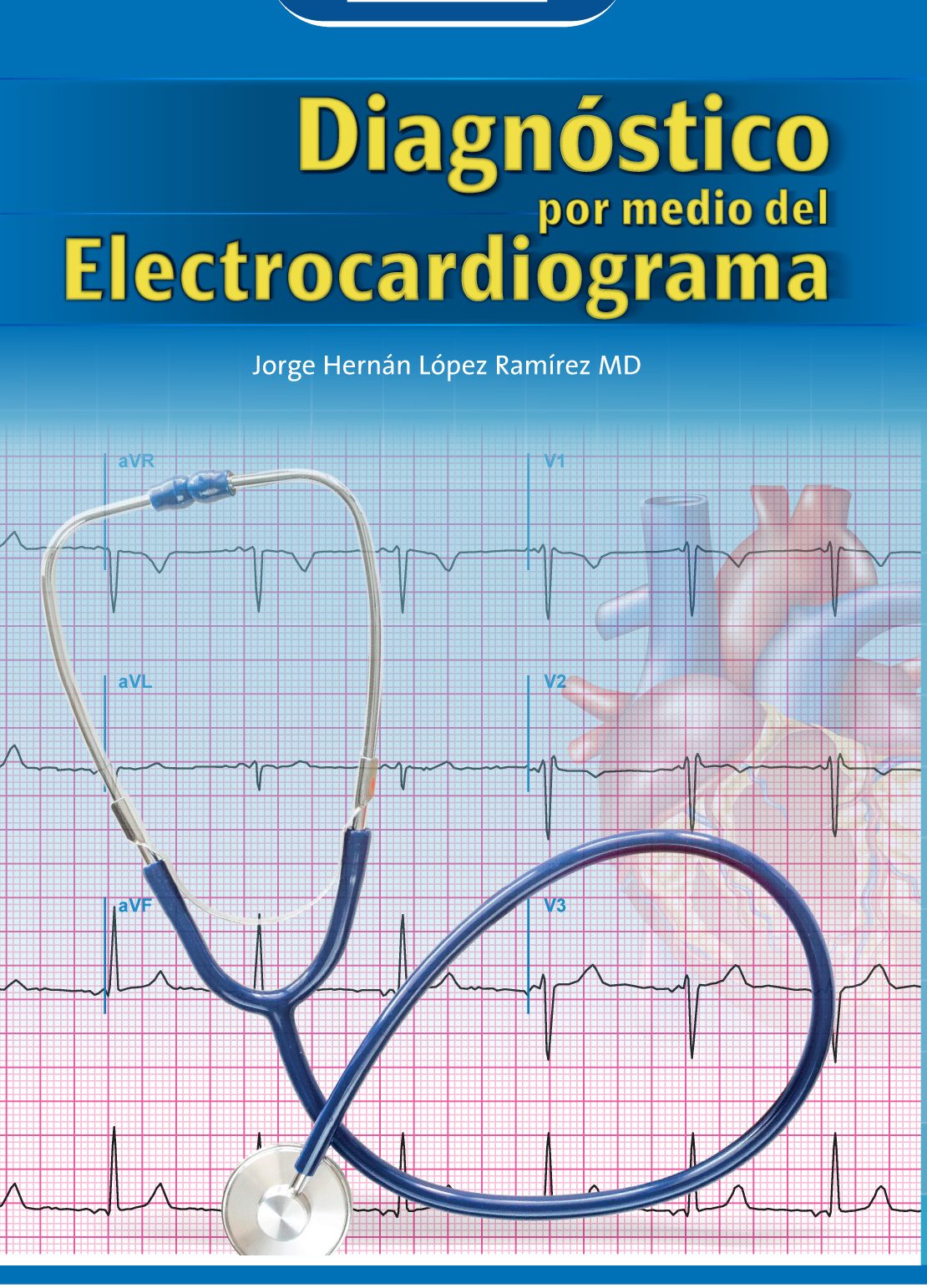Diagnóstico por medio del electrocardiograma