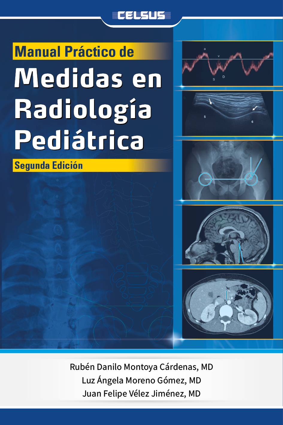 Manual practico de medidas en radiología pediátrica