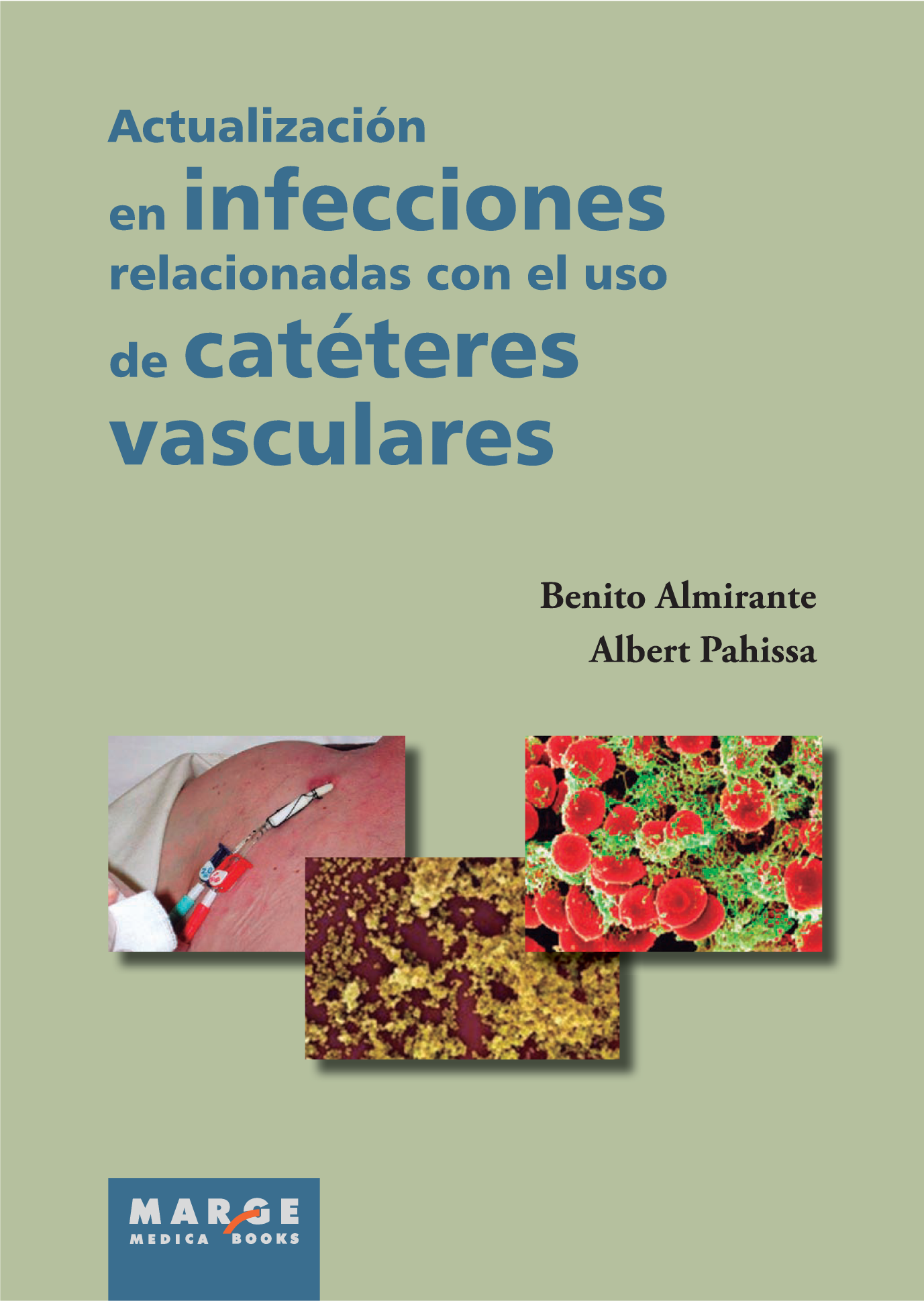 Actualización en infecciones relacionadas con el uso de catéteres vasculares
